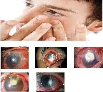 contac lenses4