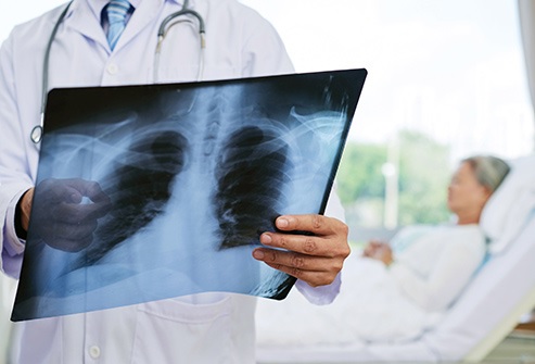 Sudden Health Problems After 50 11