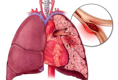 Sudden Health Problems After 50 14