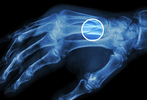 Sudden Health Problems After 50 7