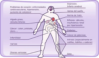 que es la obesidad 5
