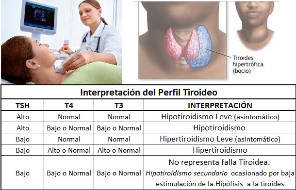 Grupo de Servicio de Trastornos de Tiroides1