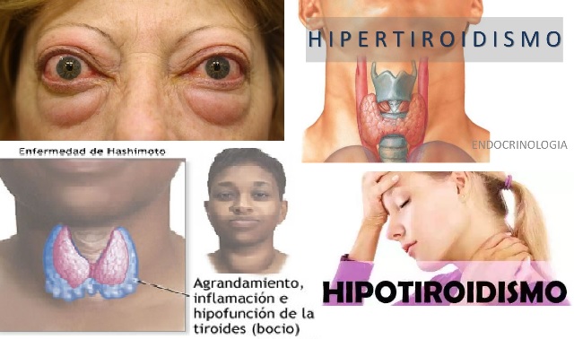 Grupo de Servicio de Trastornos de Tiroides