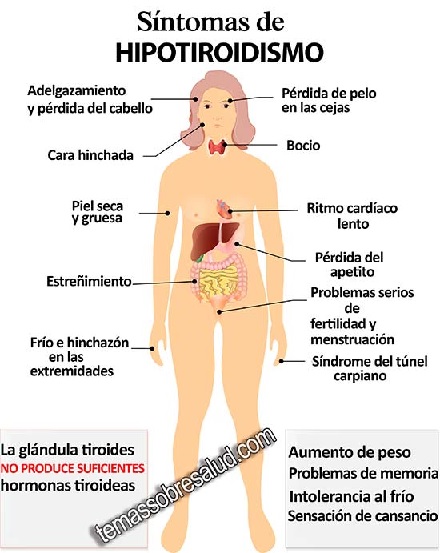 hipotiroidismo1