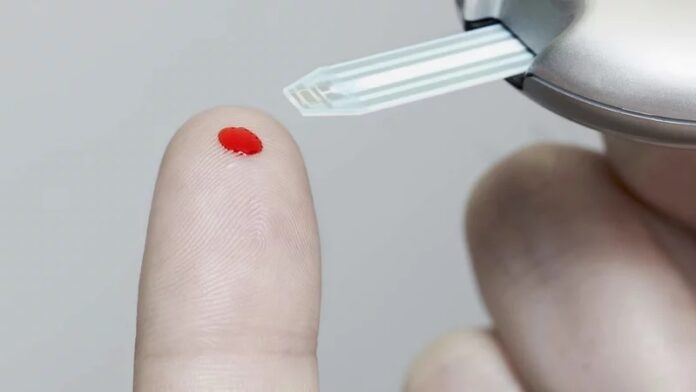 15 Ways High Blood Sugar Affects Your Body 2