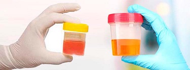 6 Symptoms You Shouldn 5