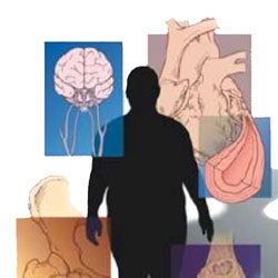 Obesity Linked to 13 Types of Cancer 2