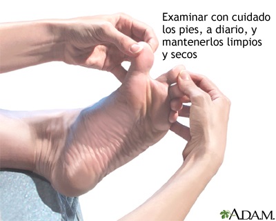 evitar complicaciones diabetes 5 