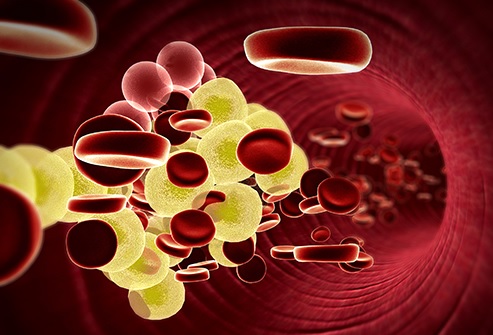 What a 5 Weight Loss Can Do for Your Health 5