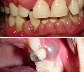 5 Síntomas extraños 2