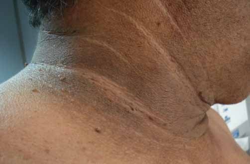 5 Síntomas extraños 3