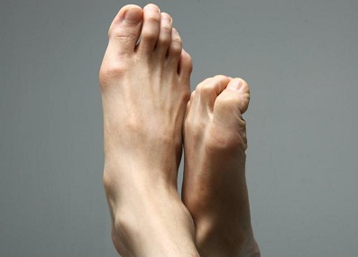 5 Síntomas extraños 4