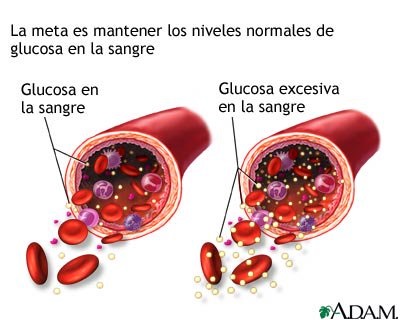7 Maneras en las que la diabetes afecta tu cuerpo 2