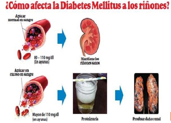 7 Maneras en las que la diabetes afecta tu cuerpo 5