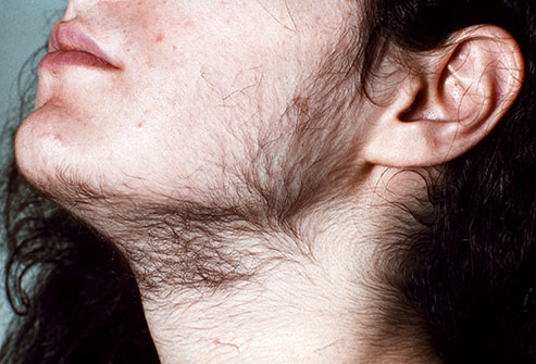 Conditions That Are Hard to Diagnose 13