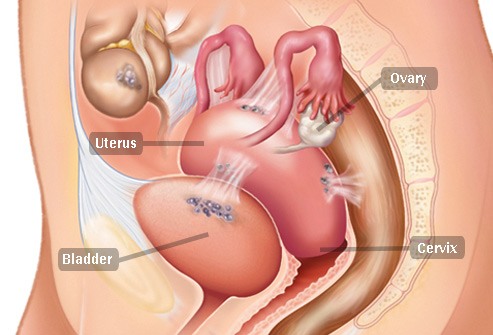 Conditions That Are Hard to Diagnose 14