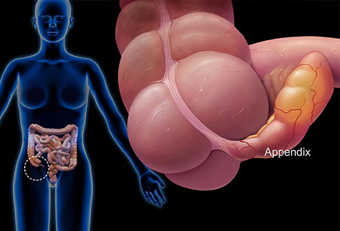 Conditions That Are Hard to Diagnose 3