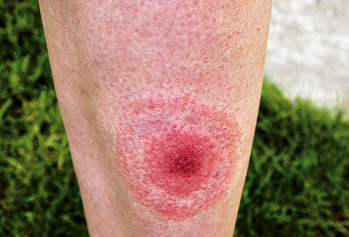 Conditions That Are Hard to Diagnose 7