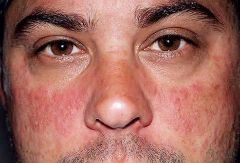Conditions That Are Hard to Diagnose 9