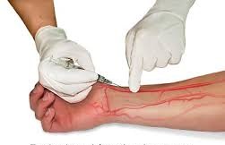 Side Effects of Donating Plasma 10