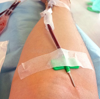 Side Effects of Donating Plasma 6