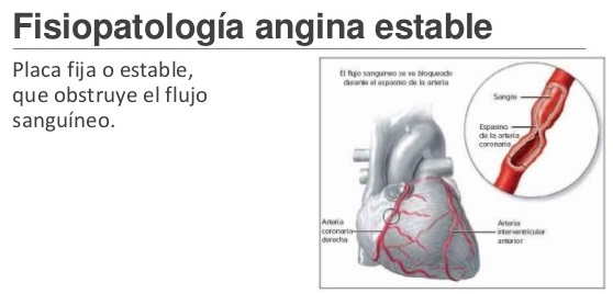 Qué es este dolor en el pecho 3