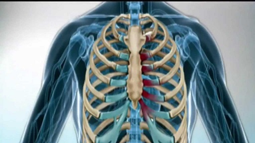 Qué es este dolor en el pecho 9