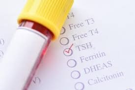 Tiroides y menopausia confundir los síntomas 4