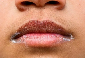 Cómo los niveles de azúcar en la sangre afectan tu cuerpo 3