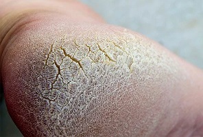 How Blood Sugar Levels Affect Your Body 4