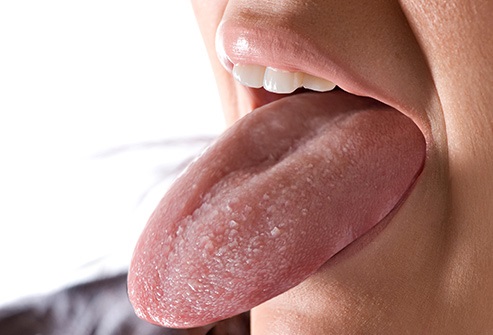 Lo que dice tu lengua sobre tu salud 10