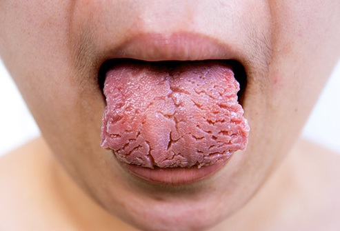 Lo que dice tu lengua sobre tu salud 11