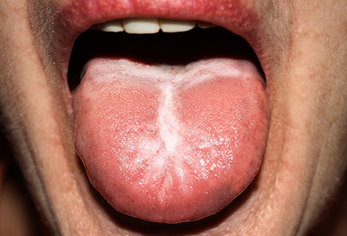 Lo que dice tu lengua sobre tu salud 2