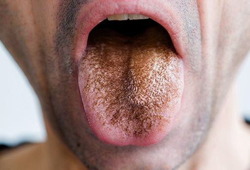 Lo que dice tu lengua sobre tu salud 3