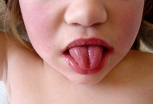 Lo que dice tu lengua sobre tu salud 5