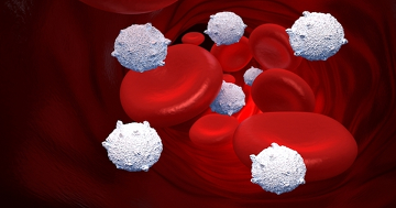 Evitar la aterosclerosis 3