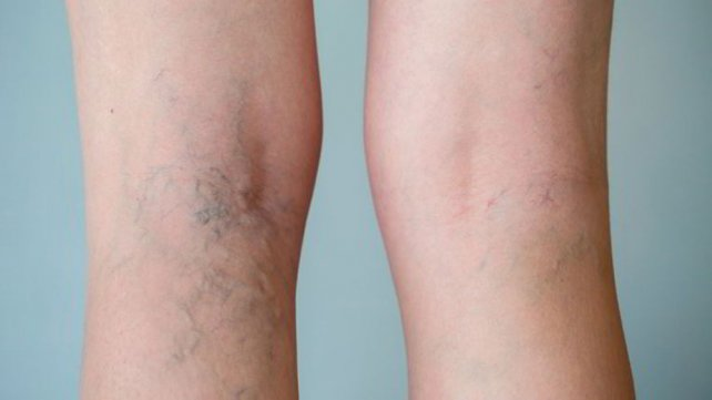 Is it dangerous to sleep sitting up 3