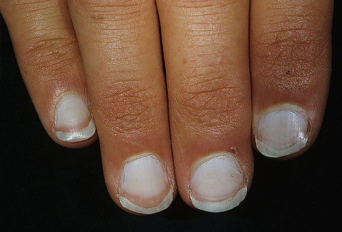 Nails and Health 3