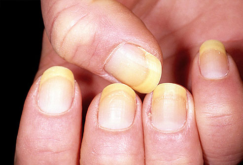 Nails and Health 4
