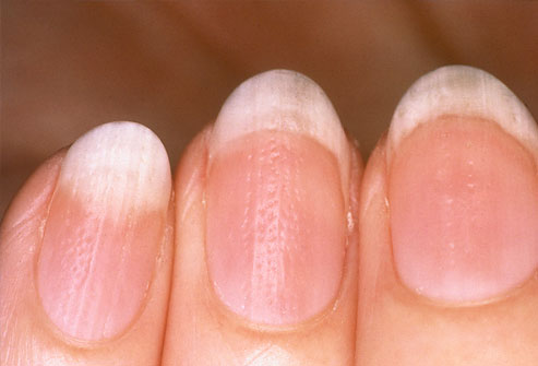 Nails and Health 6