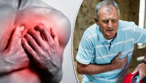 Un tipo diferente de ataque al corazón 1