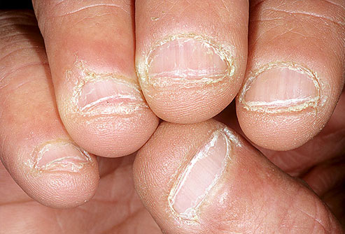 Uñas y salud 10