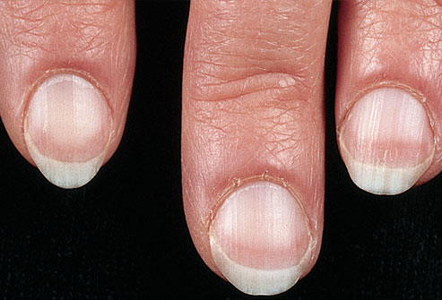 Uñas y salud 2