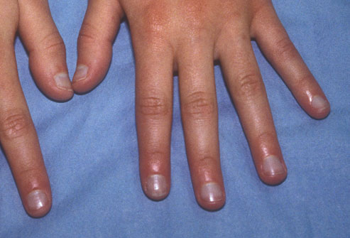 Uñas y salud 5