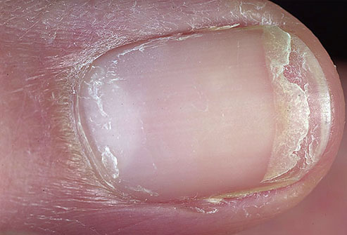 Uñas y salud 7
