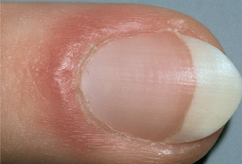 Uñas y salud 8