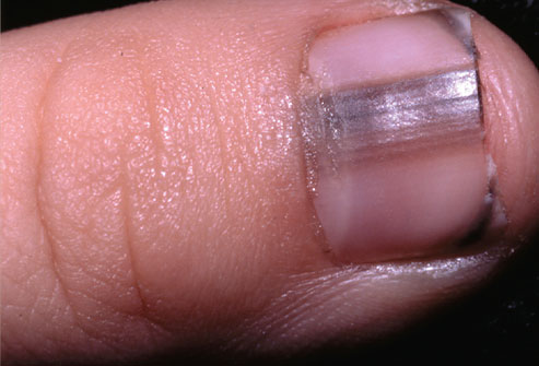 Uñas y salud 9