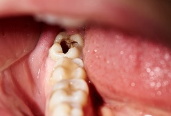 12 Ways Too Much Sugar Harms Your Body 9