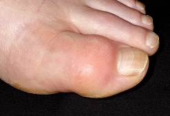 12 maneras en que el azúcar daña tu cuerpo 13