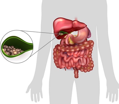 Health Risks Linked to Obesity 7